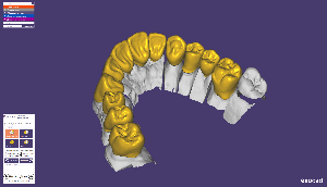 Hollywood Dental Lab – на передовой технологий. Используем новейшее программное обеспечение, чтобы создавать Ваши идеальные, здоровые улыбки.